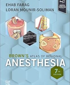 Brown's Atlas of Regional Anesthesia