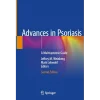 Advances in Psoriasis
