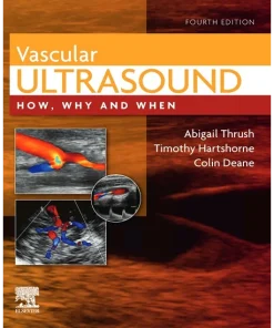 Vascular Ultrasound How Why and When