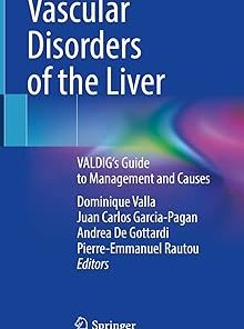 Vascular Disorders of the Liver VALDIG's Guide to Management and Causes