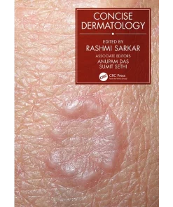 CRC Press Concise Dermatology