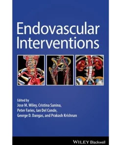 Endovascular Interventions