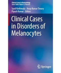 Clinical Cases in Disorders of Melanocytes