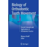 Biology of Orthodontic Tooth Movement