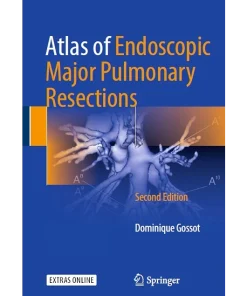 Atlas of Endoscopic Major Pulmonary Resections
