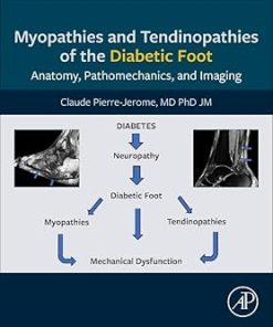 Myopathies and Tendinopathies of the Diabetic Foot AnatomyPathomechanics and Imaging