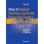 Atlas of Implant Dentistry and Tooth-Preserving Surgery