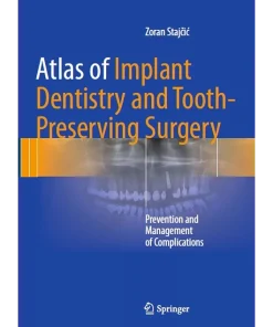 Atlas of Implant Dentistry and Tooth-Preserving Surgery