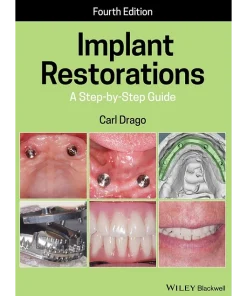 Implant Restorations