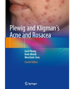 Plewig and Kligman´s Acne and Rosacea
