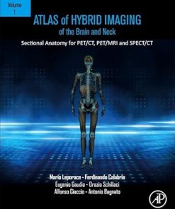 Atlas of Hybrid Imaging Sectional Anatomy for PET CT PET MRI and SPECT CT Vol 1 Brain and Neck Sectional Anatomy for PET CT PET MRI and SPECT CT