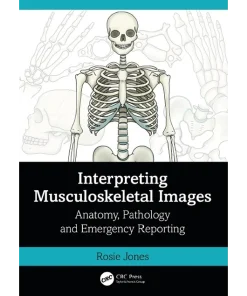 Interpreting Musculoskeletal Images Anatomy Pathology and Emergency Reporting