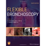 Flexible Bronchoscopy