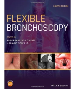 Flexible Bronchoscopy