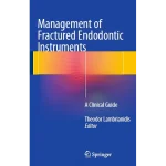 Management of Fractured Endodontic Instruments