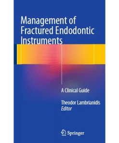 Management of Fractured Endodontic Instruments
