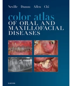 Color Atlas of Oral and Maxillofacial Diseases