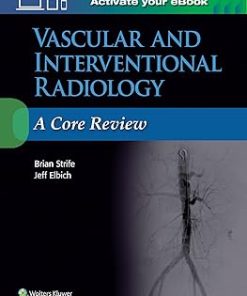 Vascular and Interventional Radiology A Core Revi