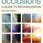 Chronic Total Occlusions A Guide to Recanalization