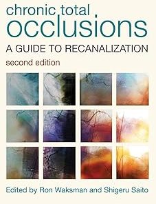 Chronic Total Occlusions A Guide to Recanalization