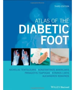 Atlas of the Diabetic Foot