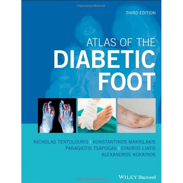 Atlas of the Diabetic Foot
