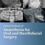 Oxford Textbook of Anaesthesia for Oral and Maxillofacial Surgery Second Edition
