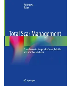Total Scar Management