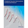 Peripheral Vascular Interventions