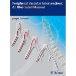 Peripheral Vascular Interventions
