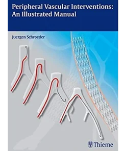 Peripheral Vascular Interventions