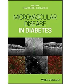 Microvascular Disease in Diabetes