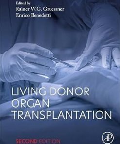 Living Donor Organ Transplantation