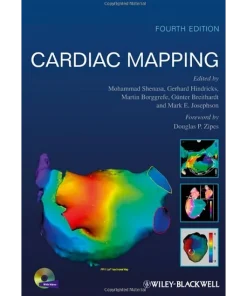 Cardiac Mapping