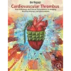 Cardiovascular Thrombus