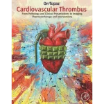Cardiovascular Thrombus