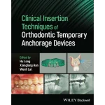 Clinical Insertion Techniques of Orthodontic Temporary Anchorage Devices