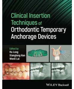 Clinical Insertion Techniques of Orthodontic Temporary Anchorage Devices