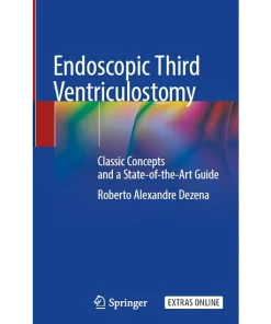 Endoscopic Third Ventriculostomy