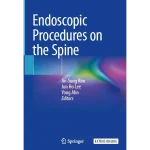 Endoscopic Procedures on the Spine