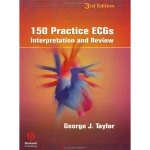 150 Practice ECGs Interpretation and Review