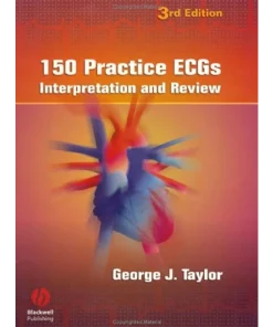 150 Practice ECGs Interpretation and Review