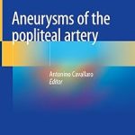 Aneurysms of the Popliteal Artery