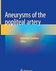 Aneurysms of the Popliteal Artery