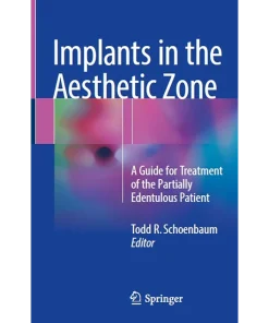 Implants in the Aesthetic Zone