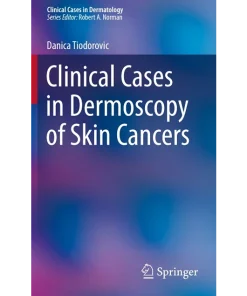 Clinical Cases in Dermoscopy of Skin Cancers