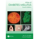Atlas of Diabetes Mellitus