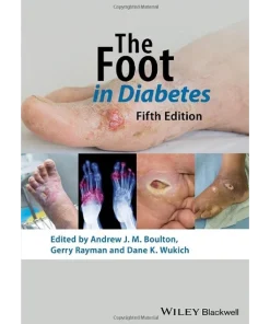 The Foot in Diabetes