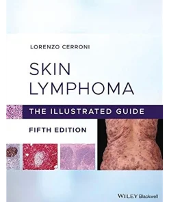 Skin Lymphoma The Illustrated Guide