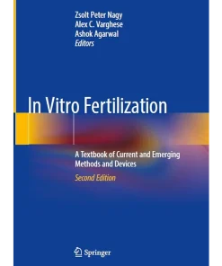 In Vitro Fertilization